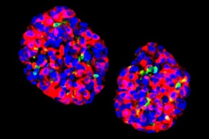 GastroCells