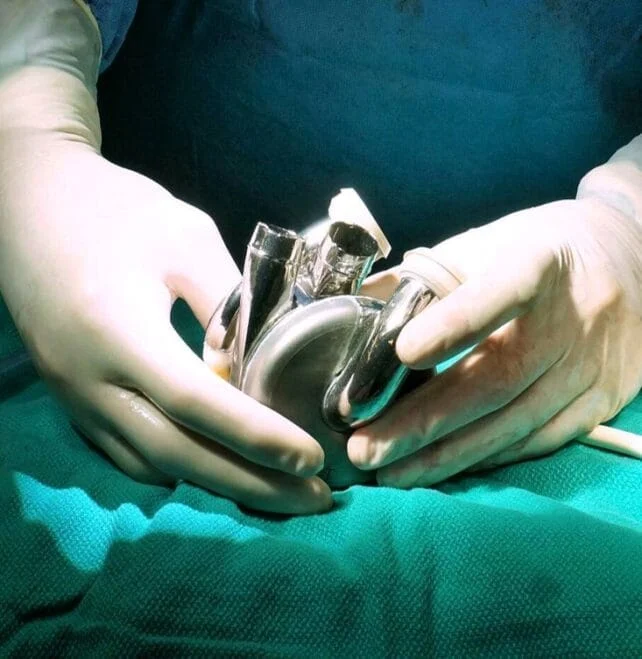 டைட்டானியத்தால் உருவான உலகின் முதல் செயற்கை இதயம்! (Artificial Heart)