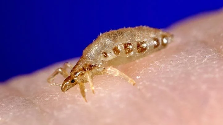 தலைப் பேன்களை நிரந்தரமாக ஒழிப்பது எப்படி? (Head Lice அறிவியல் தீர்வு)